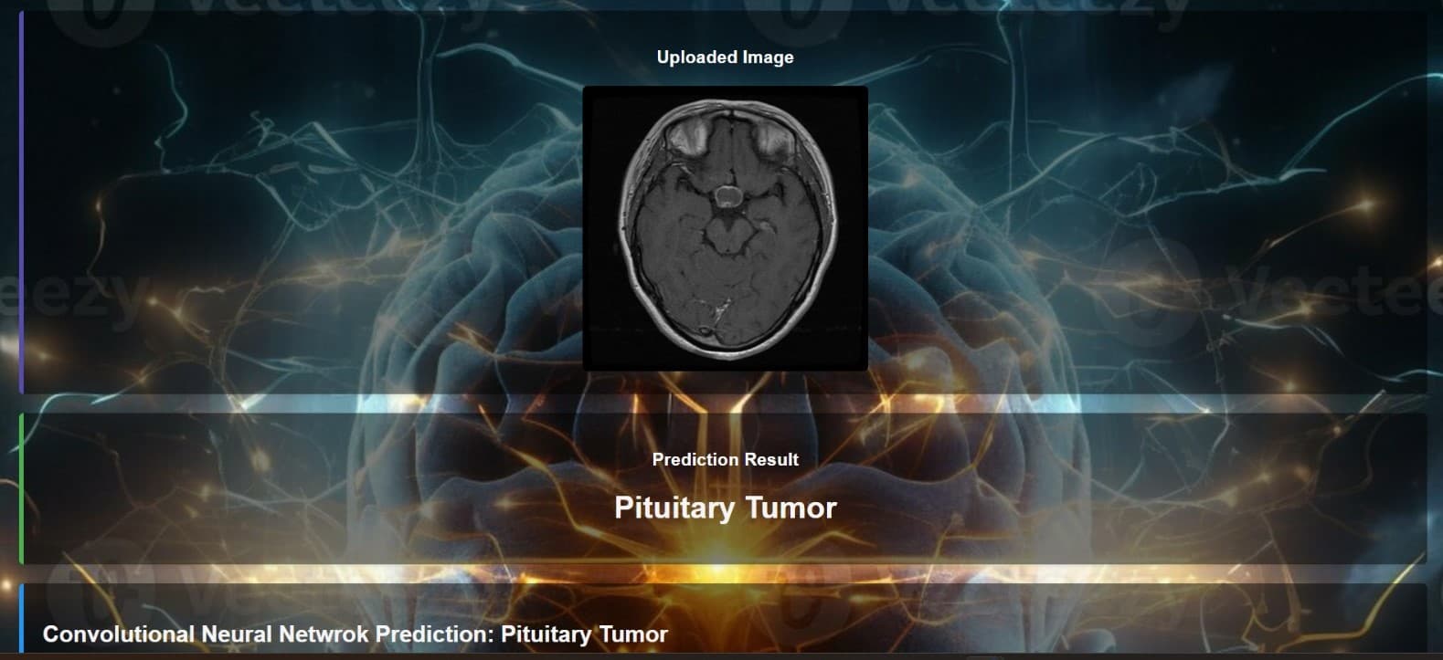 ML-Brain Tumor Detection